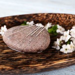 towson-acupuncture-treatments